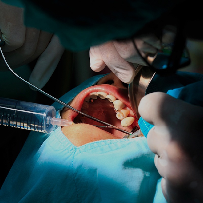 CIRUGIAS DENTOMAXILAR