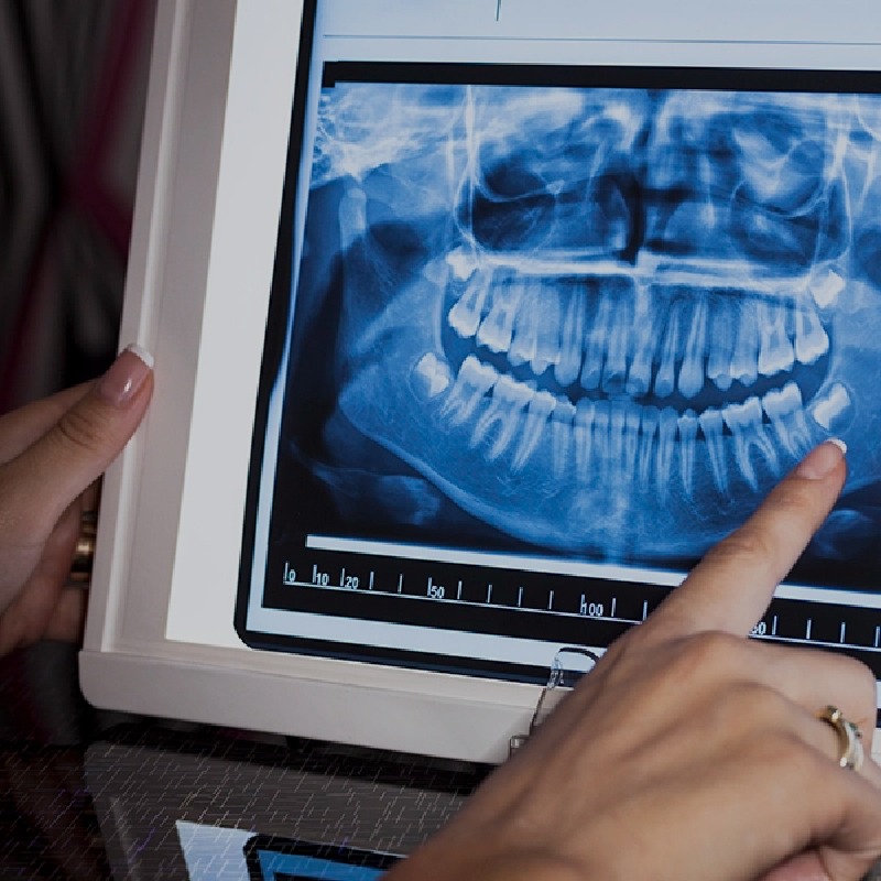 DIAGNÓSTICO POR IMÁGENES